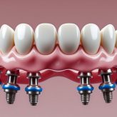Feature (4) Dentures